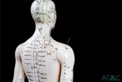 acupuncture effective therapy