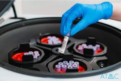 lab testing neurotoxic accumulations