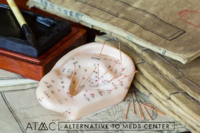 Acudetox, ear acupuncture