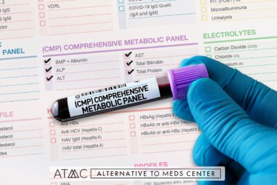 comprehensive metabolic panel