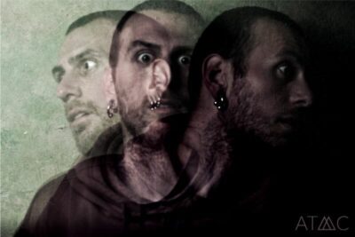 are mania and psychosis a dopamine excess