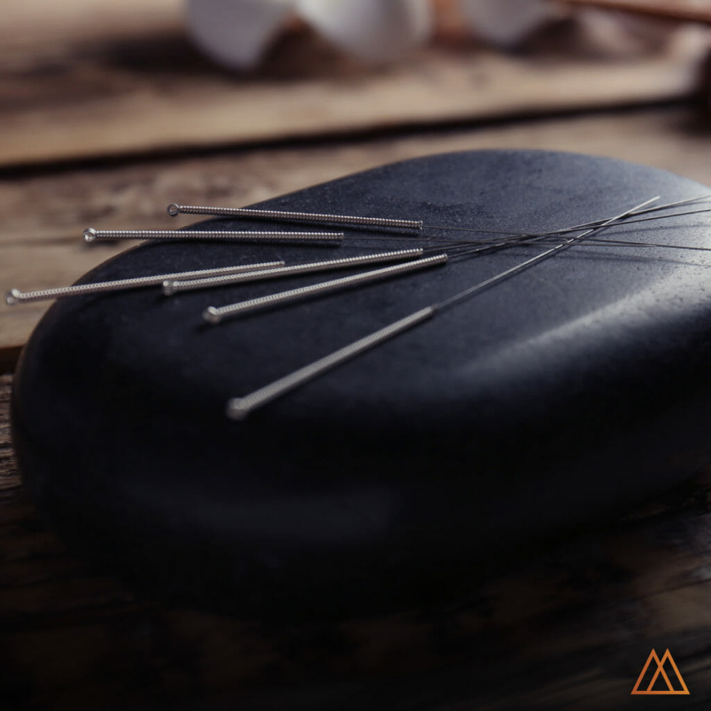 Acupuncture A Viable Alternative