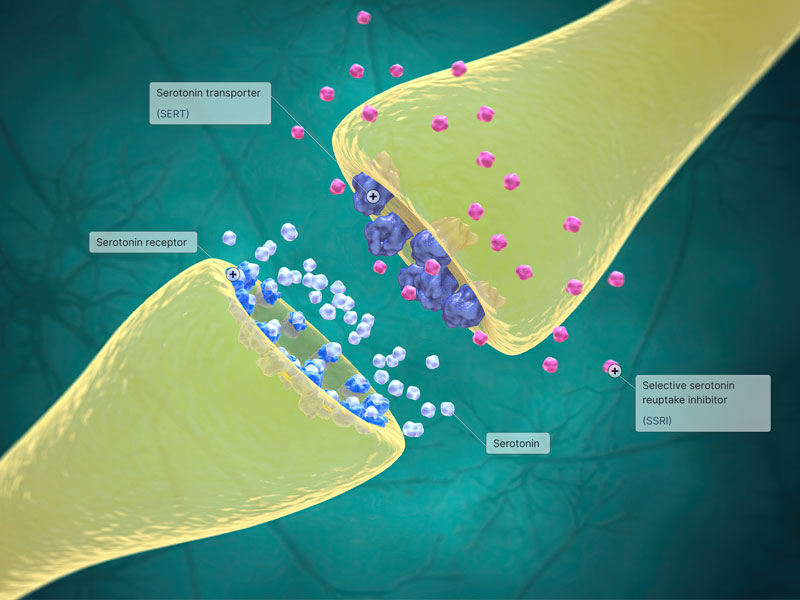 Zoloft blocks the reuptake of serotonin