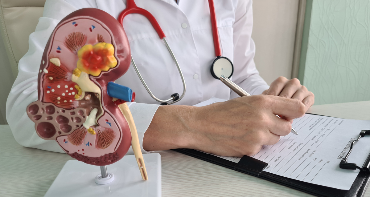 Medications That Can Cause Kidney Damage