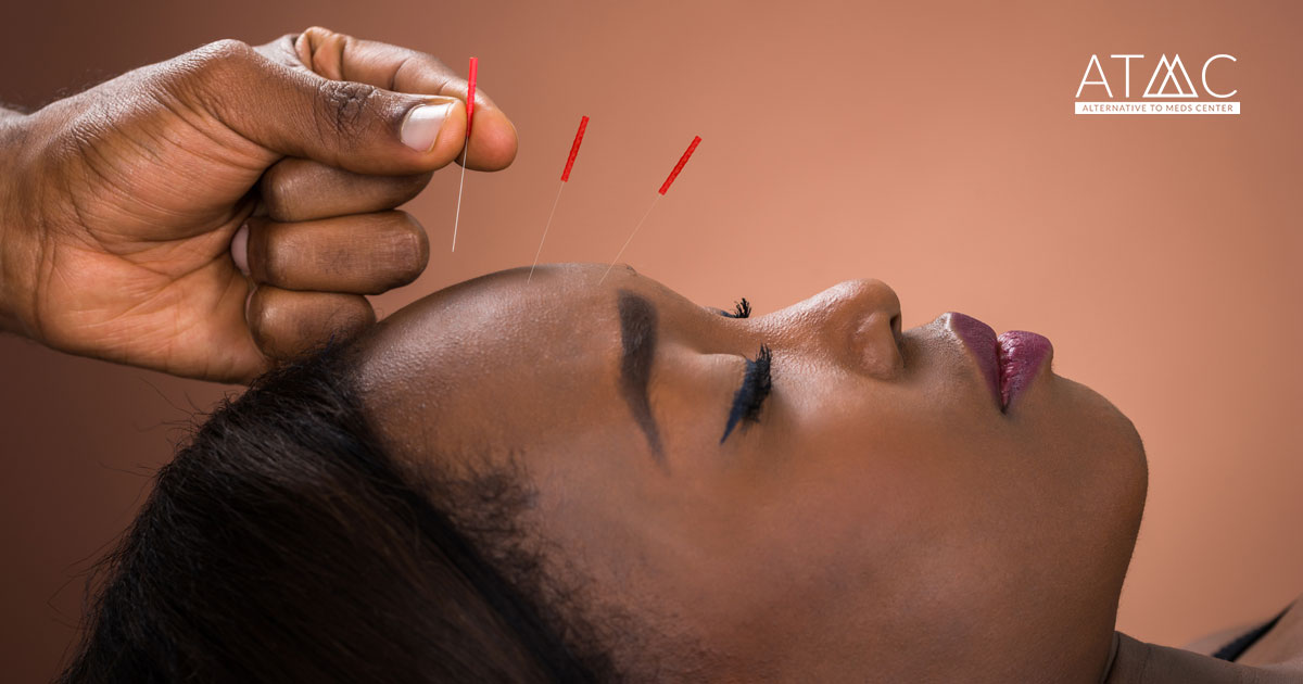 Acupuncture for Depression: The Benefits of Acupuncture for Mental Health