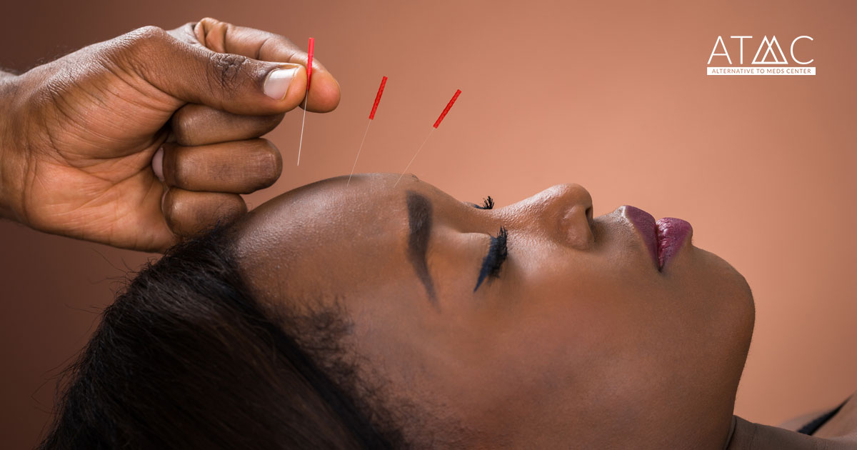 The Benefits of Acupuncture for Depression and Mental Health