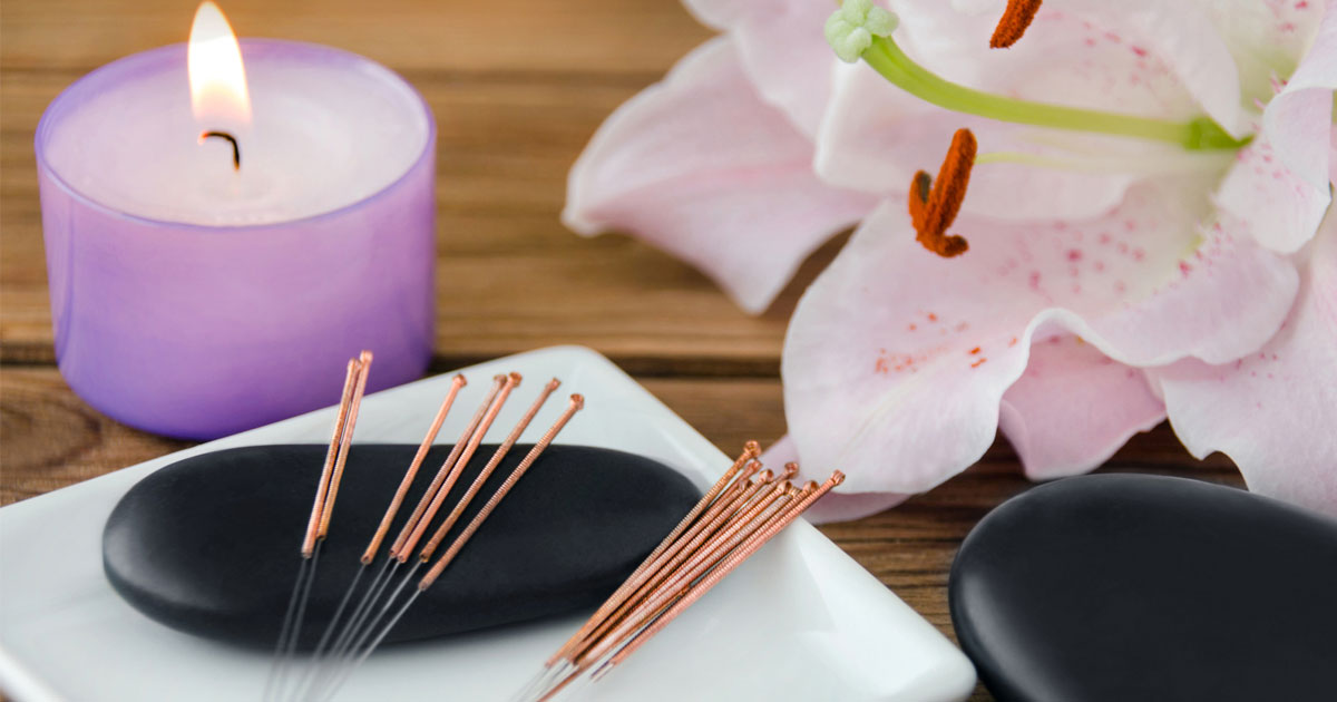 Acupuncture as a Component of Holistic Healing