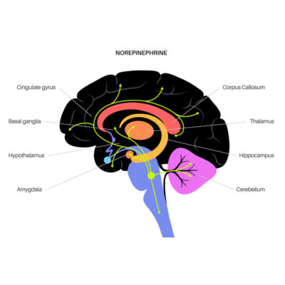 Norepinephrine